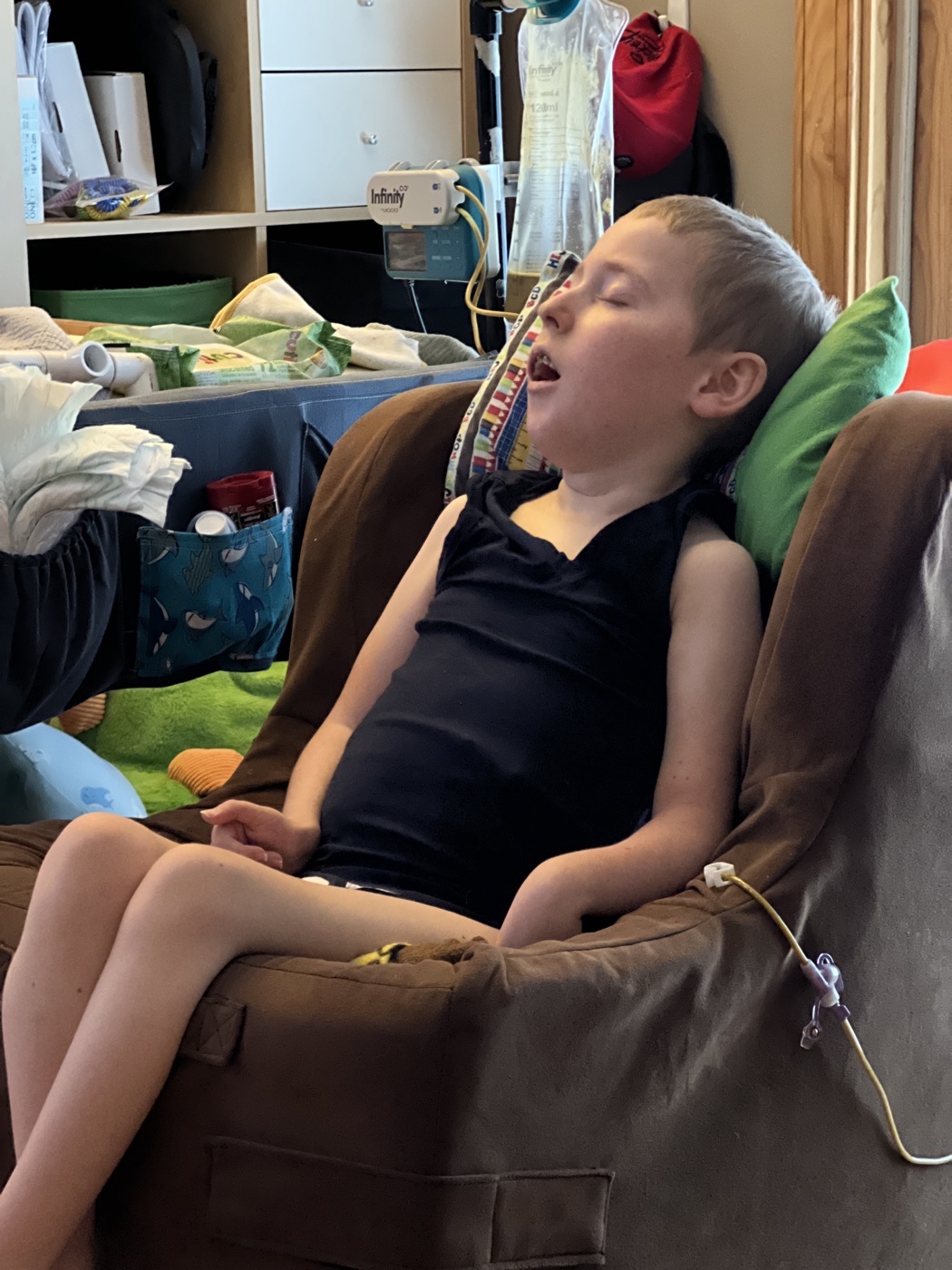 Jackson at home with his feeding pump and everyday care setup
